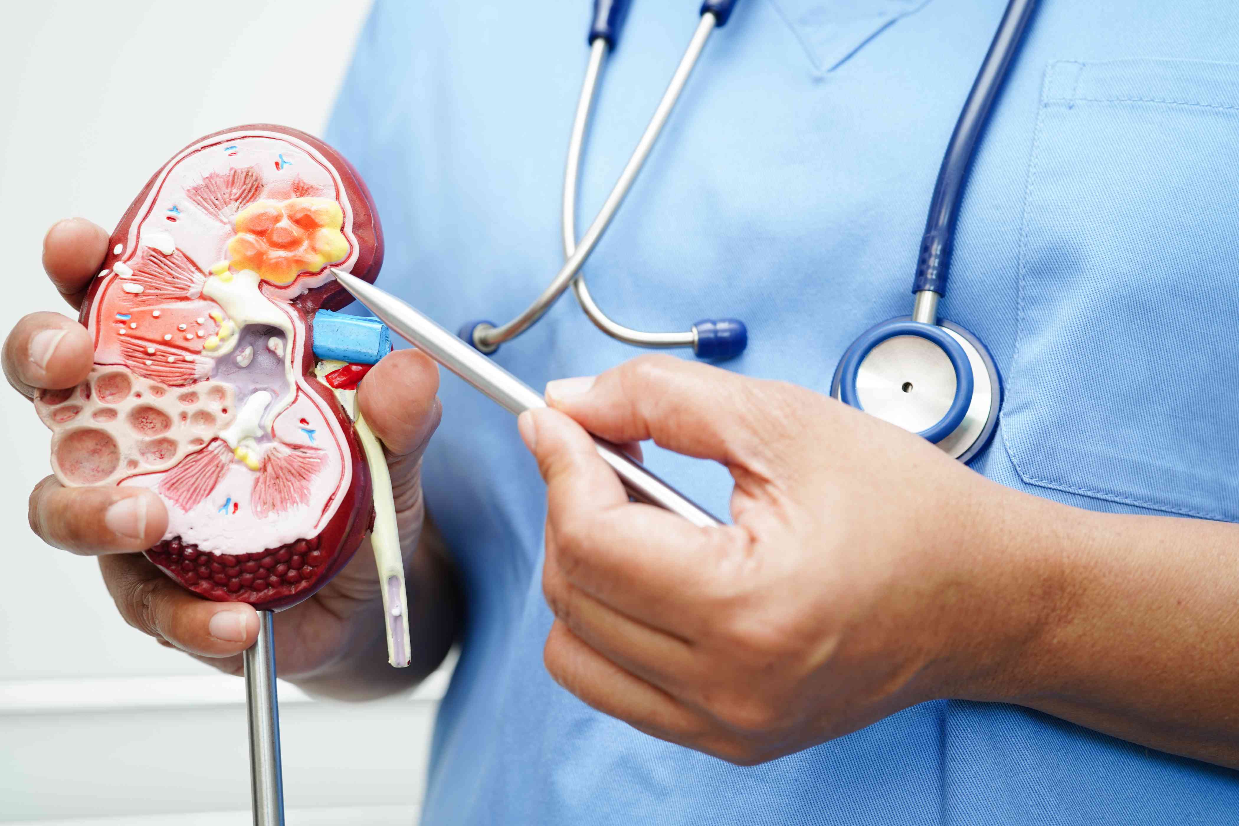 Chronic Kidney Disease